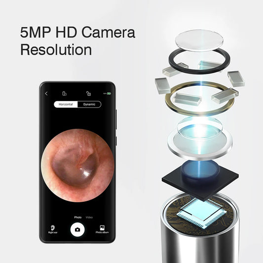 KERUI Smart Visual Ear Sticks Otoscope 5MP Endoscope Camera Wax Removal Tool Earpick Mini WIFI Camera Health Care Ear Cleaner - Home Smart Direct